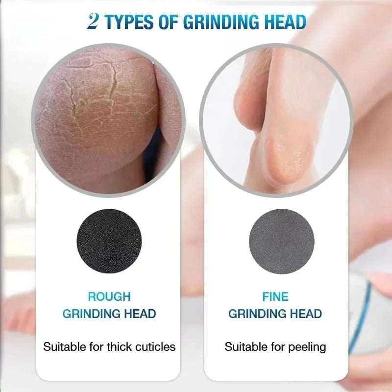Electric Callus Remover with Vacuum